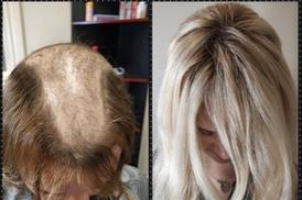 Lana's Hair Extensions - Hair extensions for thinning hair