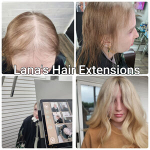 Hair-loss-Solutions Before and after Women's Hair Loss Extensions