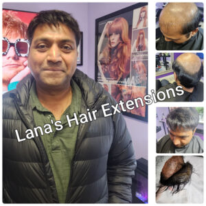Male-Hair-loss-service Male Hair Loss Service